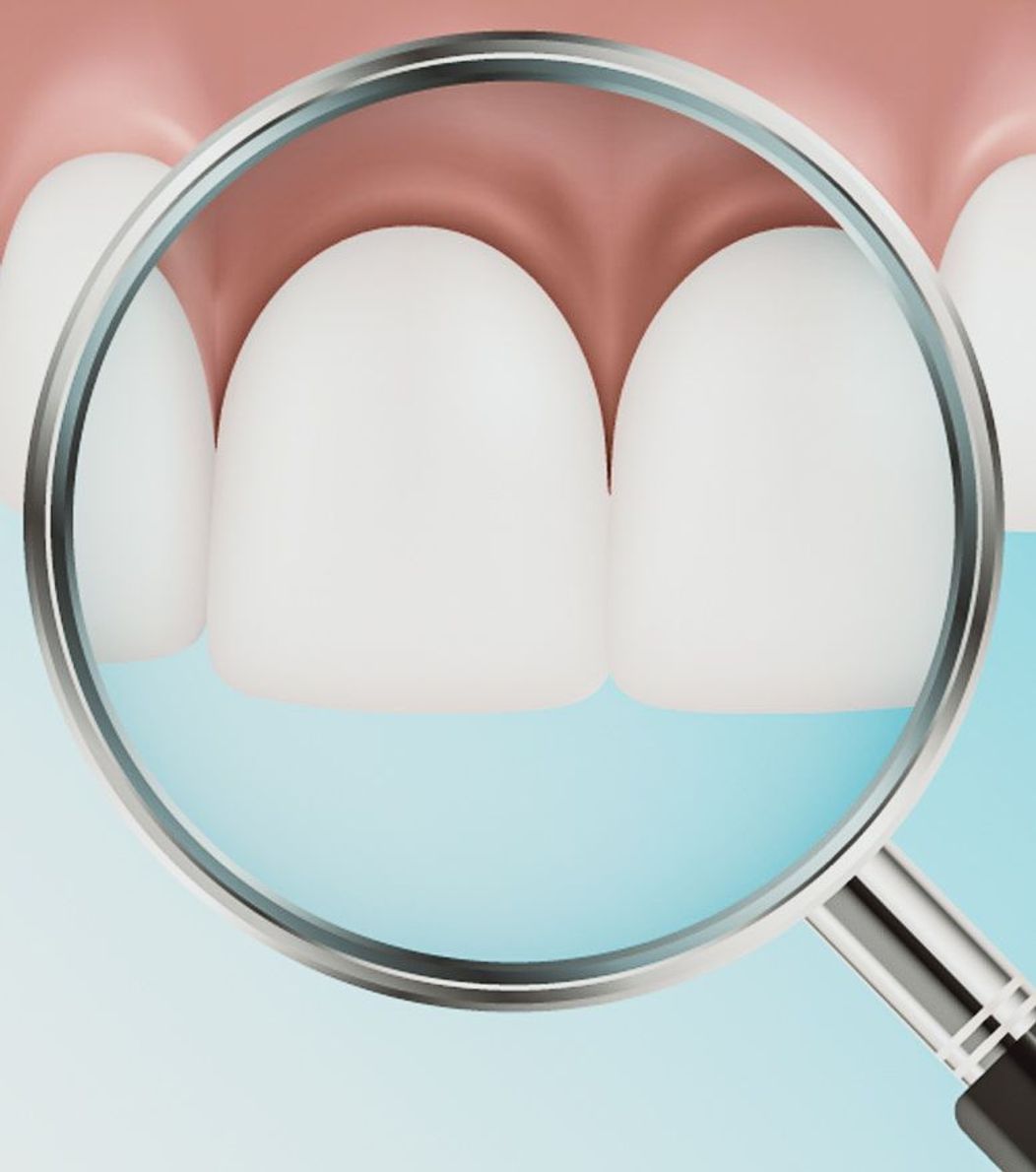 An image of a tooth being examined